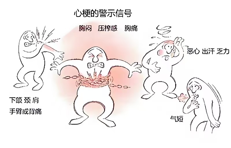 心梗突袭别慌！家属秒变 “急救助攻” 指南